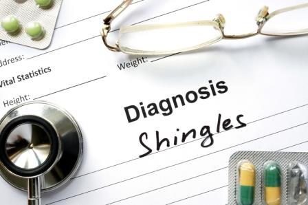 5 Things You might not know about shingles